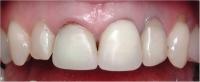 http://dr-diss-antoine.chirurgiens-dentistes.fr/dentiste/cms/upload/59_docteur-diss/fiche/01_couronne.jpg