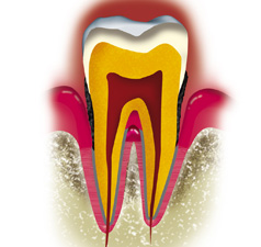 http://dr-diss-antoine.chirurgiens-dentistes.fr/dentiste/cms/upload/59_docteur-diss/fiche/parodontite.jpg