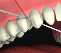 http://dr-diss-antoine.chirurgiens-dentistes.fr/dentiste/cms/upload/59_docteur-diss/fiche/FICHE_ETAPE2APPRENTISSAGE-DU-CONTROLE-DE-PLAQUEfildentaire2.gif