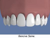 http://dr-diss-antoine.chirurgiens-dentistes.fr/dentiste/cms/upload/2_source/gencive-saine%20legende(2).jpg