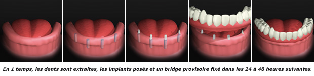 http://dr-diss-antoine.chirurgiens-dentistes.fr/dentiste/cms/upload/59_docteur-diss/fiche/edente.jpg