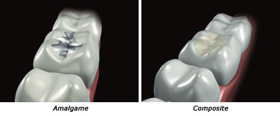 http://dr-diss-antoine.chirurgiens-dentistes.fr/dentiste/cms/upload/59_docteur-diss/fiche/ama-compo.jpg